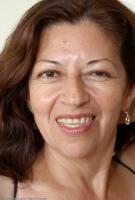 ATK hairy  in mature and hairy