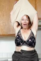 ATK hairy  in mature and hairy