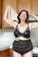 ATK hairy  in mature and hairy