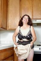 ATK hairy  in mature and hairy