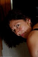 ATK hairy  in mature and hairy