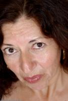 ATK hairy  in mature and hairy