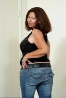 ATK hairy  in mature and hairy