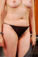 ATK hairy  in mature and hairy