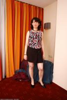 ATK hairy  in mature and hairy