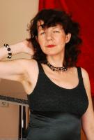 ATK hairy  in mature and hairy