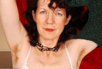 ATK hairy  in mature and hairy