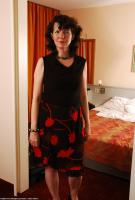 ATK hairy  in mature and hairy