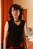 ATK hairy  in mature and hairy