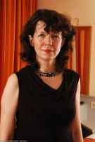 ATK hairy  in mature and hairy