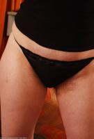 ATK hairy  in mature and hairy
