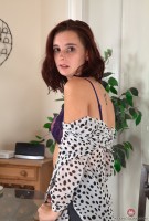 ATK hairy  in young and hairy