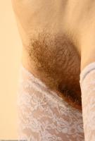 ATK hairy  in mature and hairy