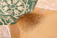 ATK hairy  in mature and hairy