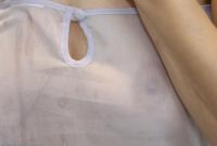 ATK hairy  in mature and hairy