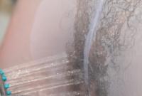 ATK hairy  in mature and hairy