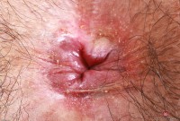 ATK hairy Hazel Heart Set
