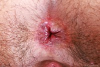 ATK hairy Hazel Heart Set