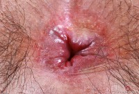 ATK hairy Hazel Heart Set