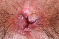 ATK hairy Hazel Heart Set