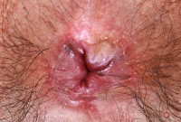 ATK hairy Hazel Heart Set
