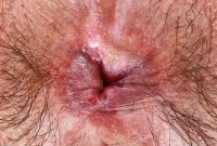 ATK hairy Hazel Heart Set