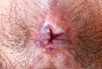 ATK hairy Hazel Heart in exotic and hairy