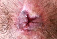 ATK hairy Hazel Heart in exotic and hairy