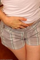 ATK hairy  in mature and hairy