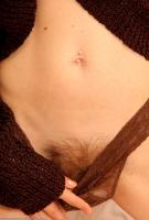 ATK hairy  in mature and hairy