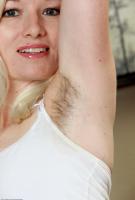 ATK hairy  in mature and hairy