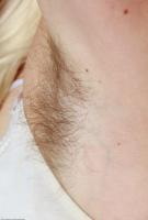 ATK hairy  in mature and hairy