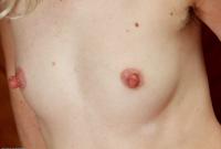 ATK hairy  in mature and hairy