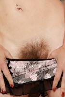 ATK hairy  in mature and hairy