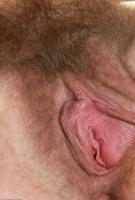 ATK hairy  in mature and hairy