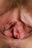 ATK hairy  in mature and hairy