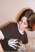 ATK hairy  in mature and hairy