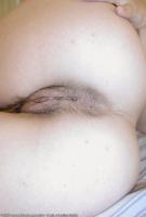 ATK hairy  in mature and hairy