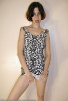 ATK hairy  in mature and hairy