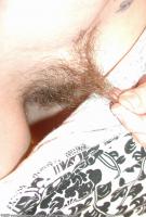 ATK hairy  in mature and hairy
