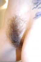 ATK hairy  in mature and hairy