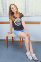 ATK hairy  in young and hairy