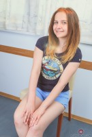 ATK hairy  in young and hairy