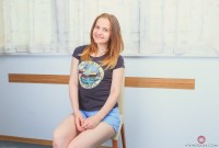 ATK hairy  in young and hairy