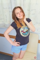 ATK hairy  in young and hairy