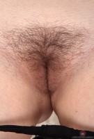 ATK hairy Irelia Atwood Set