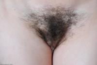 ATK hairy  in mature and hairy
