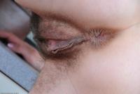 ATK hairy  in mature and hairy