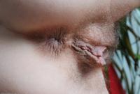 ATK hairy  in mature and hairy