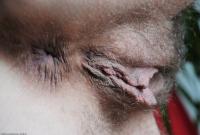 ATK hairy  in mature and hairy